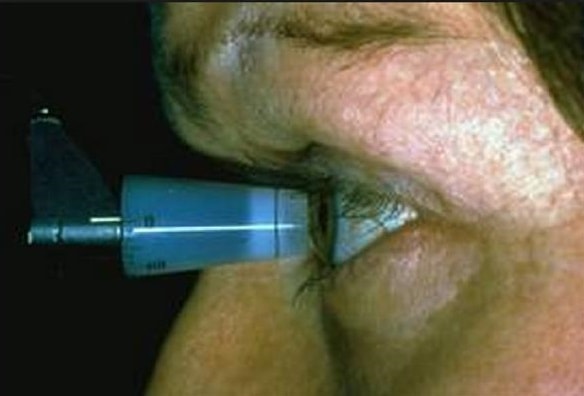 Measuring Intraocular pressure