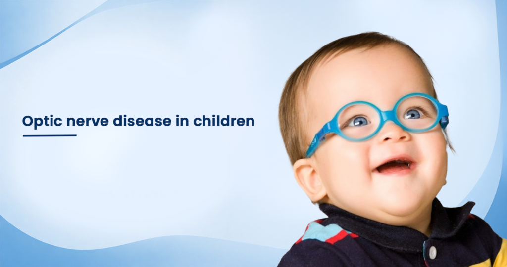 Optic nerve disease in children